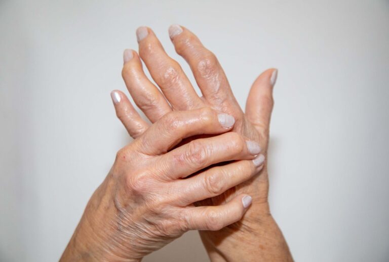 Read more about the article Can you mix DMARDs with opioids for rheumatoid arthritis?