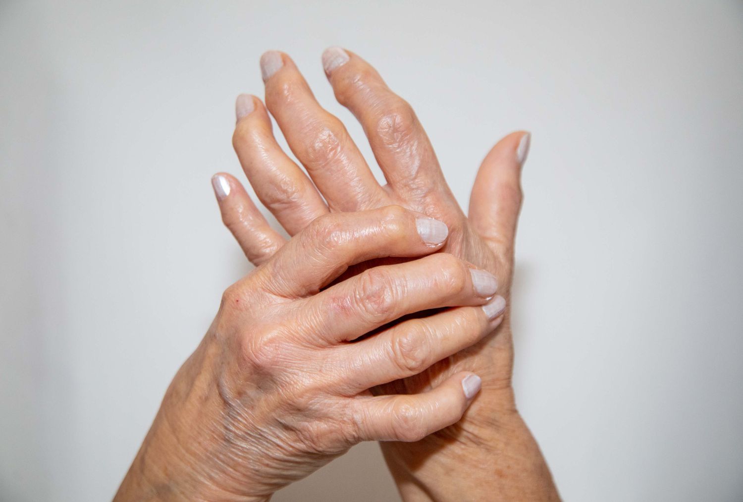 You are currently viewing Can you mix DMARDs with opioids for rheumatoid arthritis?
