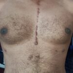 Shocking Truth About Lifelong Childhood Injury Scars: 9 Powerful Facts You Must Know