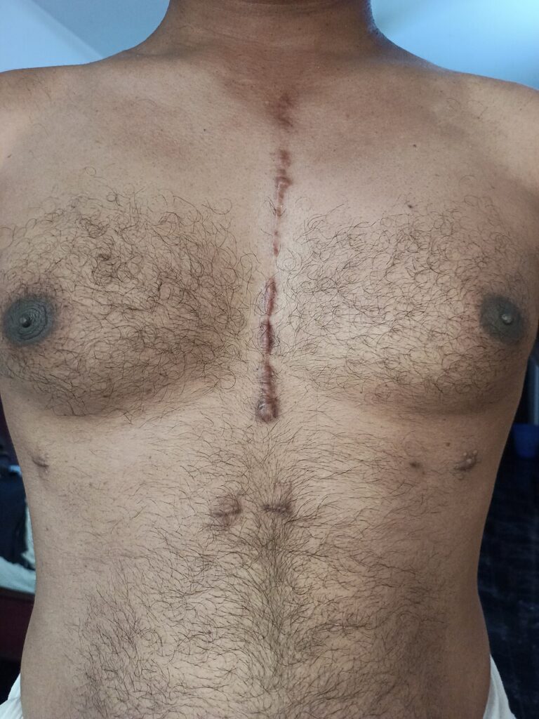 Read more about the article Shocking Truth About Lifelong Childhood Injury Scars: 9 Powerful Facts You Must Know