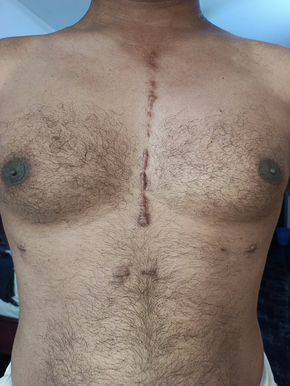 You are currently viewing Shocking Truth About Lifelong Childhood Injury Scars: 9 Powerful Facts You Must Know