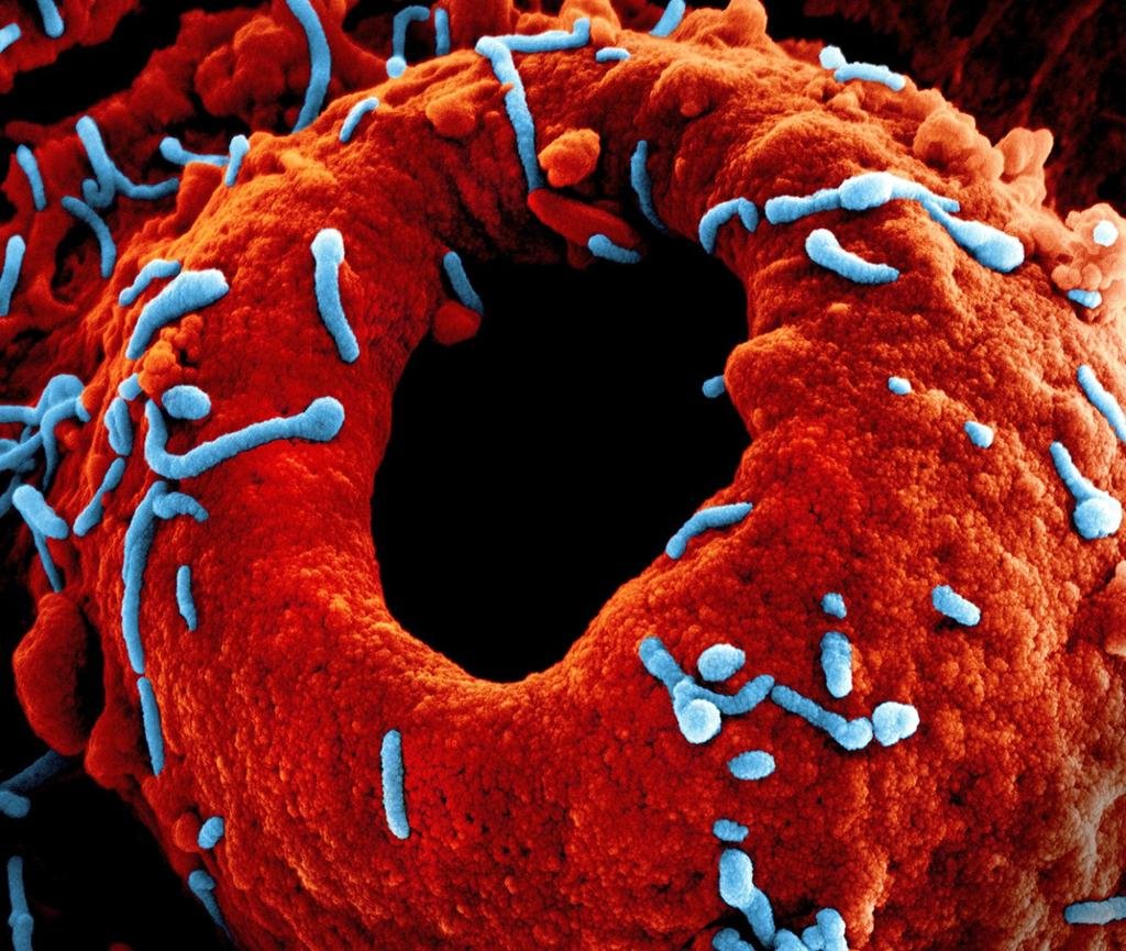 You are currently viewing Marburg Virus vs. Ebola: Key Differences in Transmission, Fatality, and Treatment