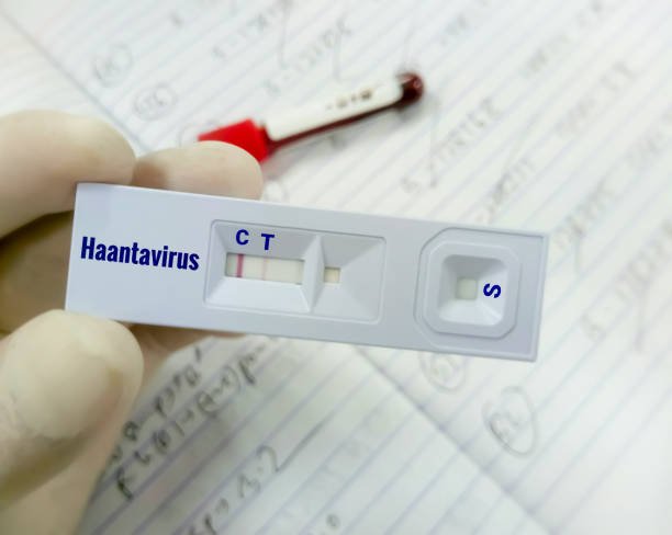 Read more about the article How Travelers and Outdoor Enthusiasts Can Stay Safe from Hantavirus in Europe