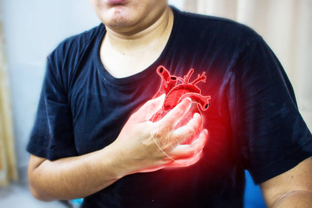 Read more about the article How CHD Develops Over Decades: From Fatty Streaks to Heart Attack