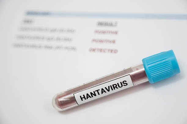 Read more about the article How Hantaviruses Spread in Europe: From Rodents to Humans