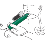 Zero Pain Scores in Prostate Biopsies: How Penthrox Enables Pain-Free Cancer Screening